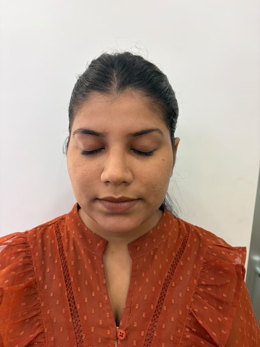 Patient skin rejuvenation and even tone restoration after customized facial protocol at ABSOLUT AURAA